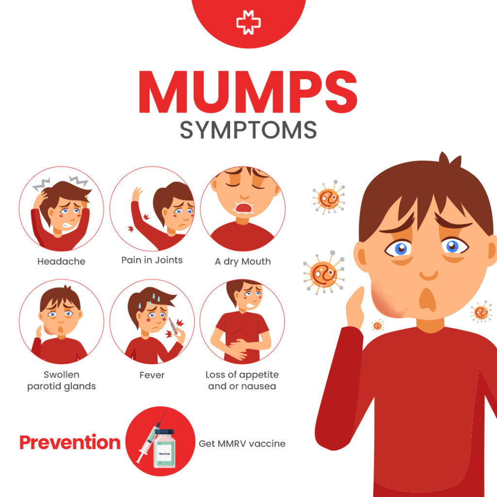 Mumps: Causes, Symptoms, and Effective Treatment